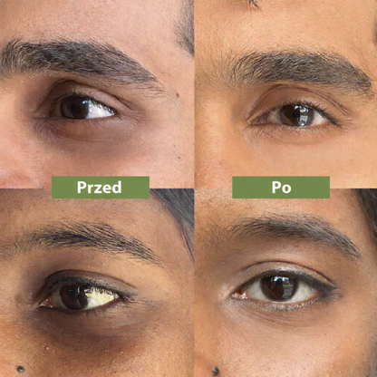 Dr. Melaxin | Eye Bright Corrector